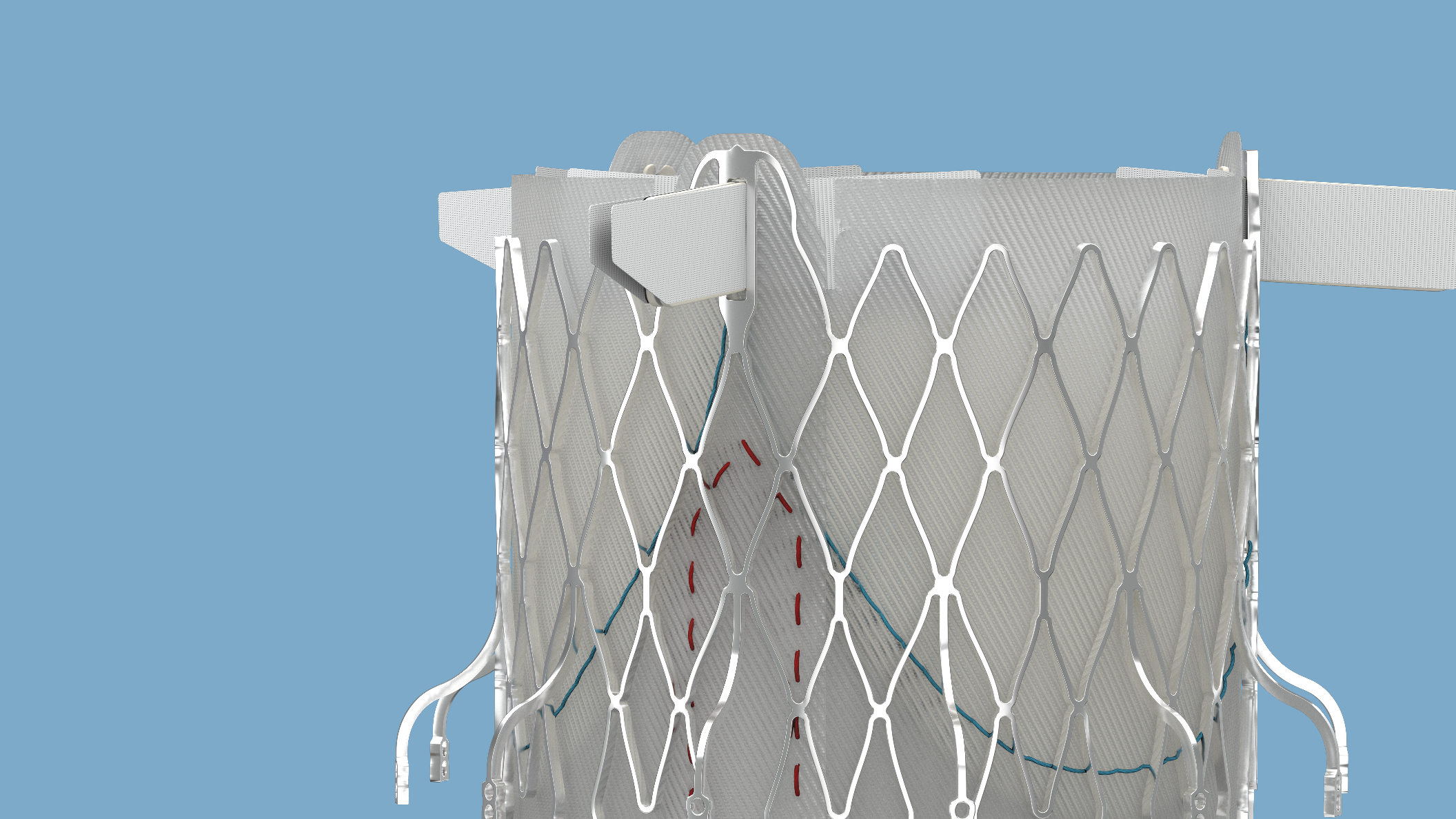 3D Animation Medical Device Training_2